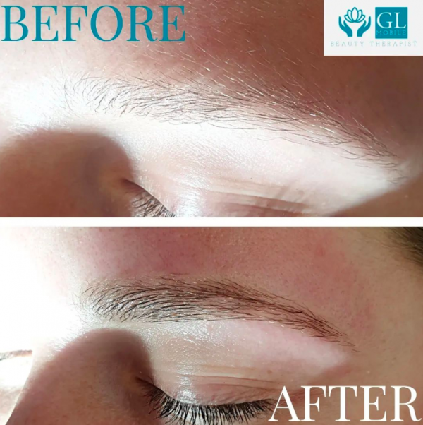 eyebrow treatment before and after